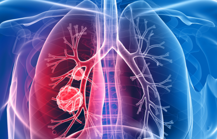 XÁC ĐỊNH VI KHUẨN LAO (TB) BẰNG KỸ THUẬT REALTIME PCR