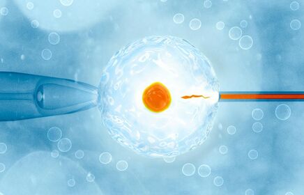 APPLICATION OF NGS–ILLUMINA IN PREIMPLANTATION GENETIC TESTING FOR ANEUPLOIDY PGT-A