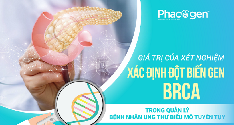 Quản lý các bệnh nhân ung thư biểu mô tuyến tuỵ mang đột biến gen BRCA
