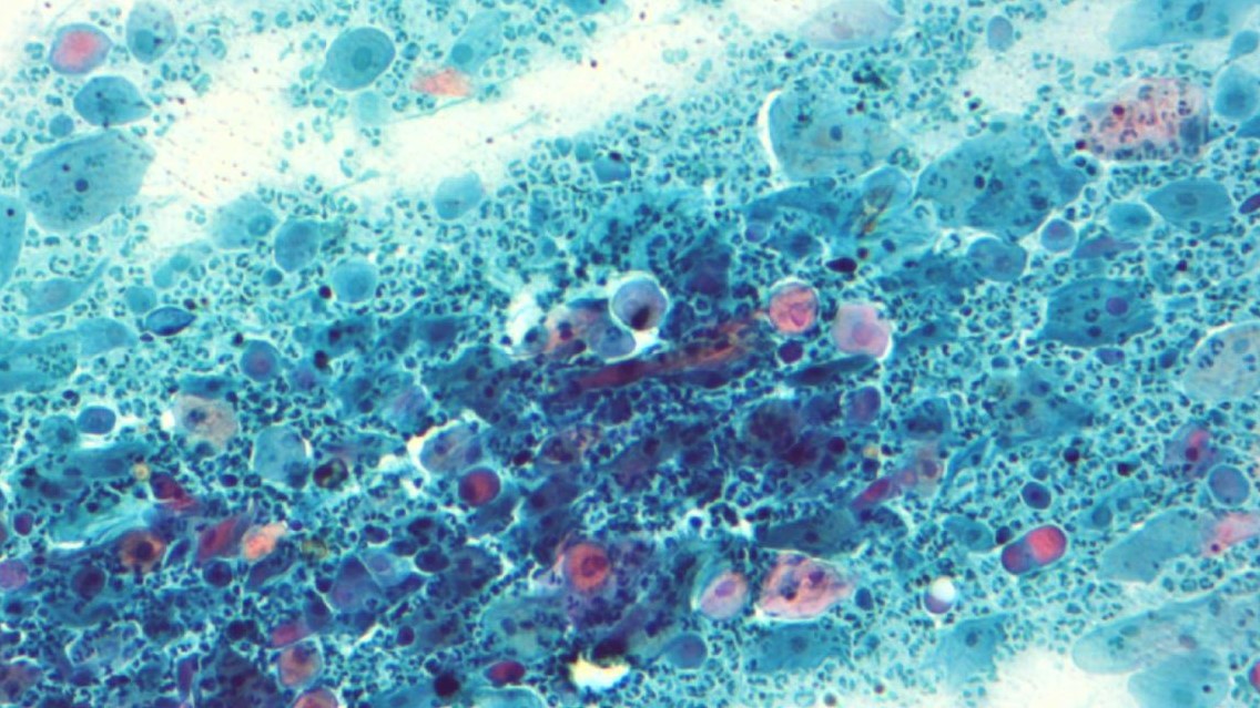 Vaginal smear staining to detect pathogens - Class 2